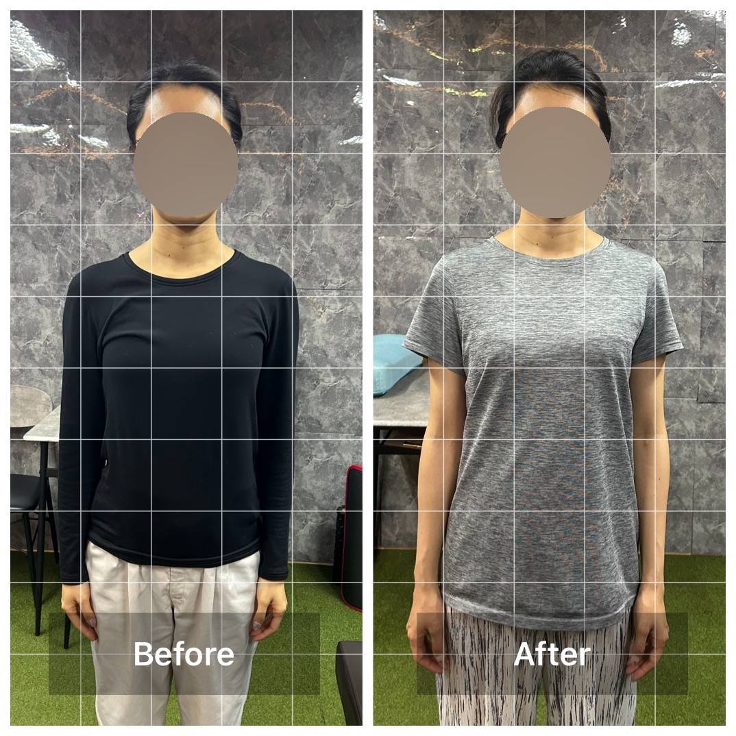 S様のビフォーアフター写真